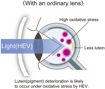 Eye exposed to HEV light