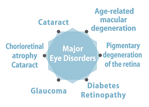 Eye Disorders